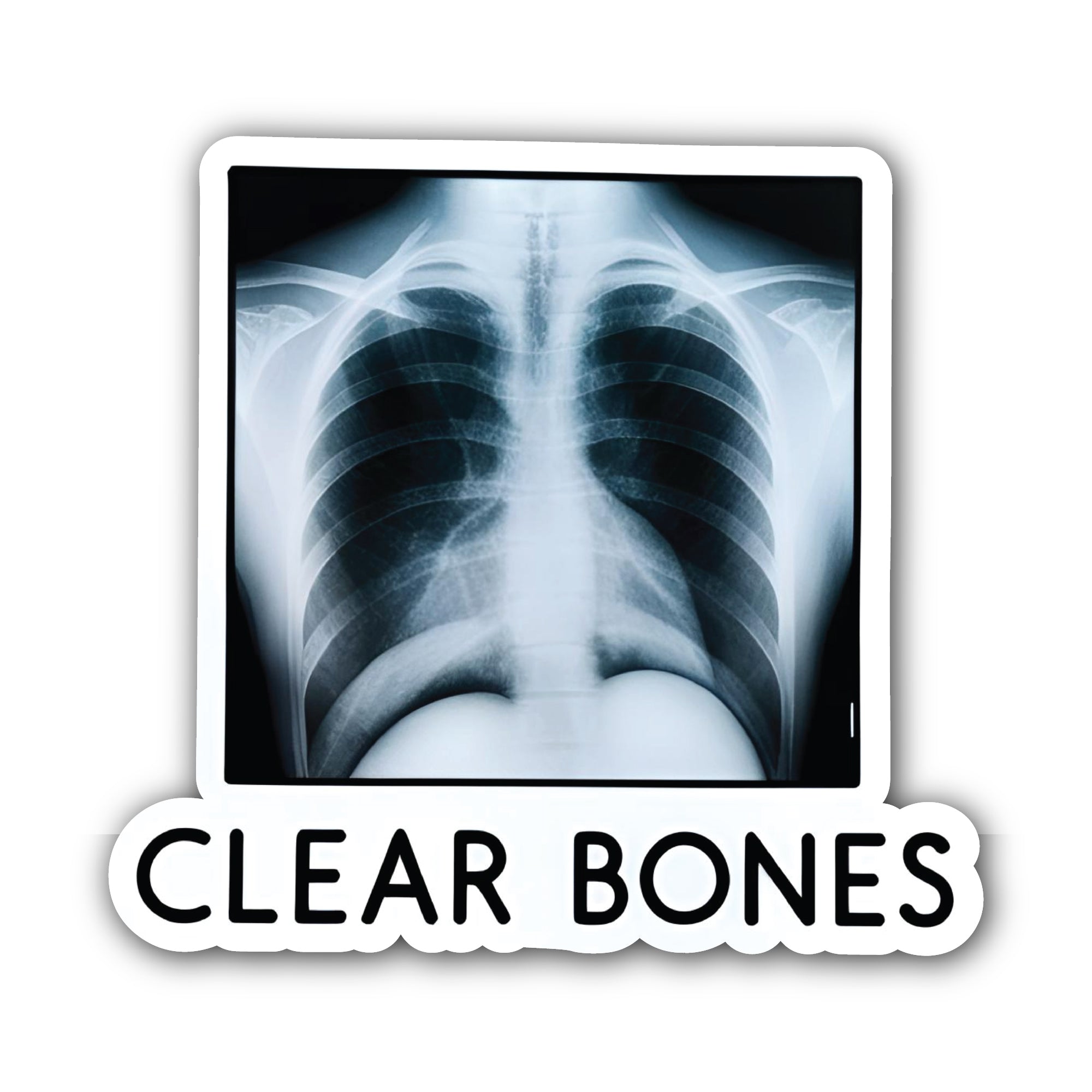 Clear Bones Sticker, Waterproof Vinyl Decal Sticker Indoor Or Outdoor 2 (Pieces) 3" and 5"